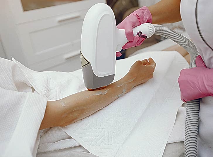 IPL Lazer Epilasyon Nasıl Uygulanır?, IPL Lazer Epilasyon Kalıcı Etki Eder mi? ve IPL Lazer Epilasyonu Avantajları